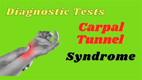 durkan carpal compression test|tinel test vs phalen.